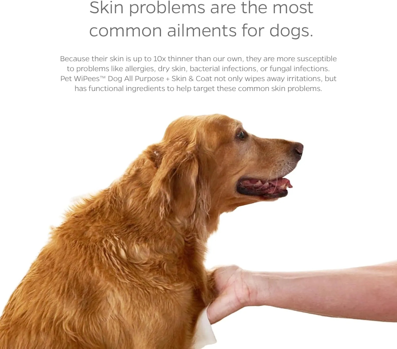 Pet Parents Pet WiPees Dog All Purpose   Skin & Coat Pet Wipes, Pet Wipes for Dogs, Dog Wipes & Puppy Wipes, Paw Wipes for Dogs (100 Count (Pack of 2), Calming)